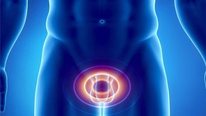 Prostatitis pain